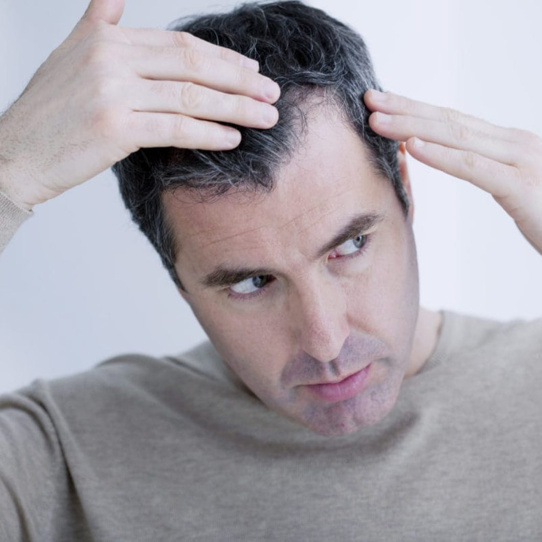 Hair Loss Treatment Plan - m