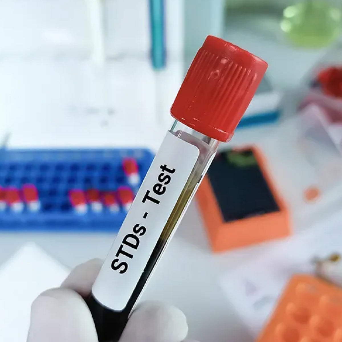 STI/STD Test – Burst Health