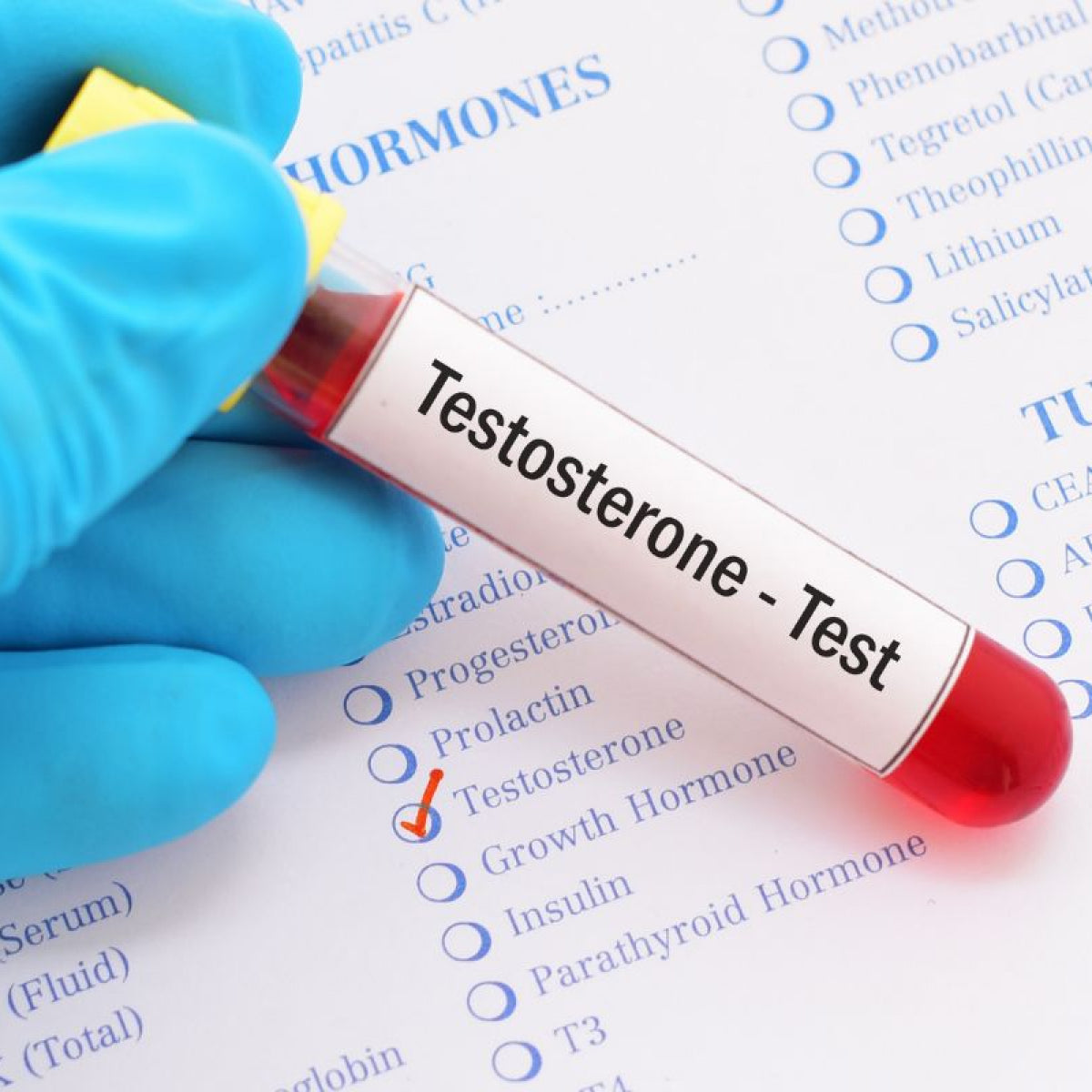 Testosterone Test – Burst Health