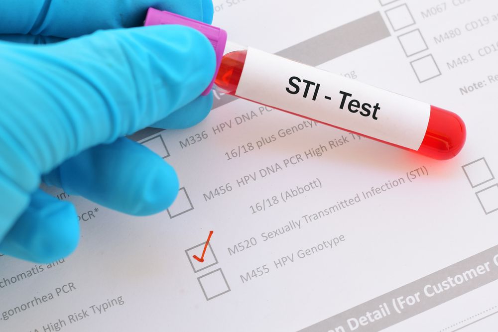STI/STD tests