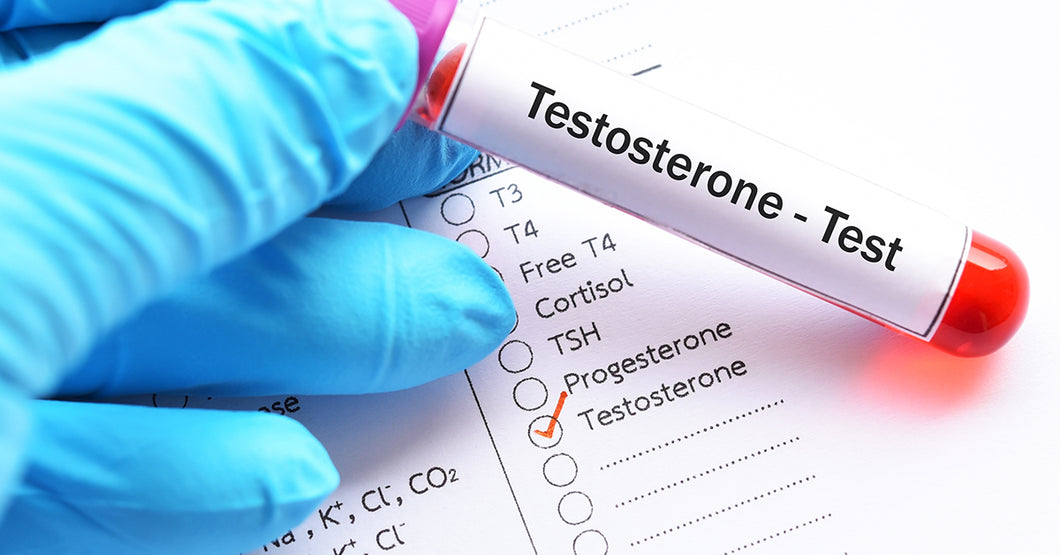 Erectile dysfunction testosterone test